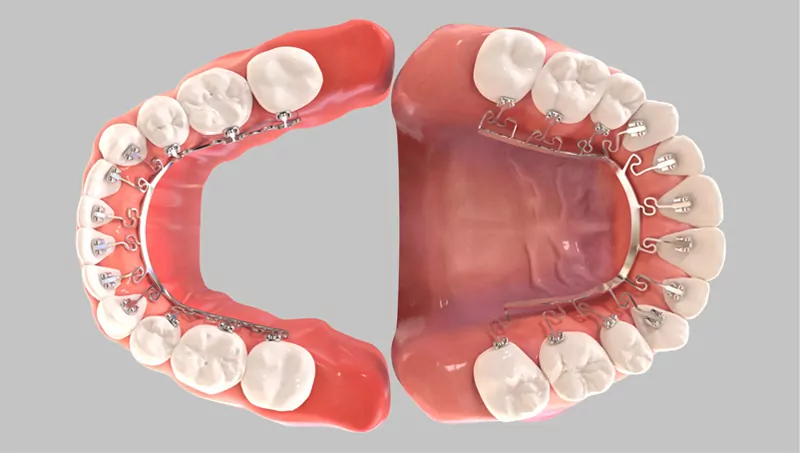 Knoxville Orthodontics