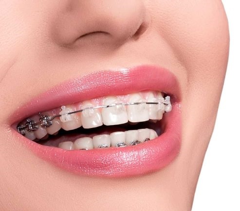 Knoxville Orthodontics