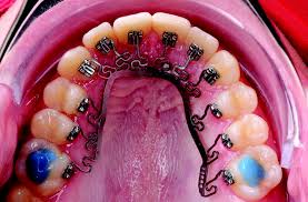 Knoxville Orthodontics