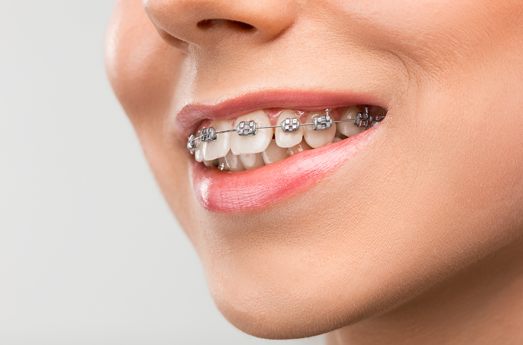 Knoxville Orthodontics Knoxville Orthodontics